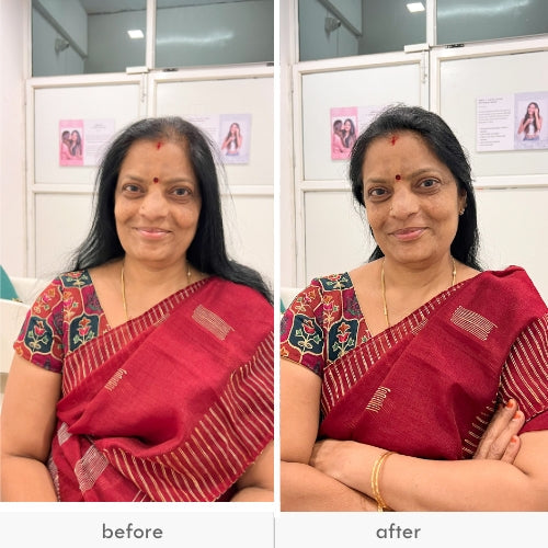 Woman showing visible hair volume improvement before and after treatment