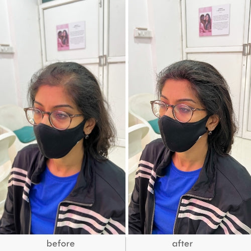 Before and after images of a woman wearing glasses and a face mask, showing the effect of an invisible push-up hair patch on her hair volume.