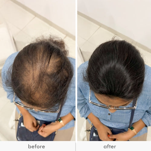 Before and after images of a woman using an invisible push-up hair patch.