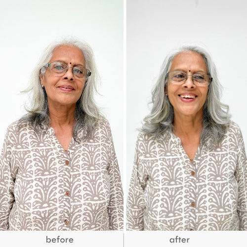 Before and after images of an older woman with gray hair, showing the effect of an invisible push-up hair patch.