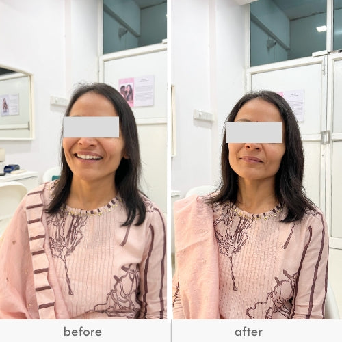 Before and after images of a woman with improved hair volume.